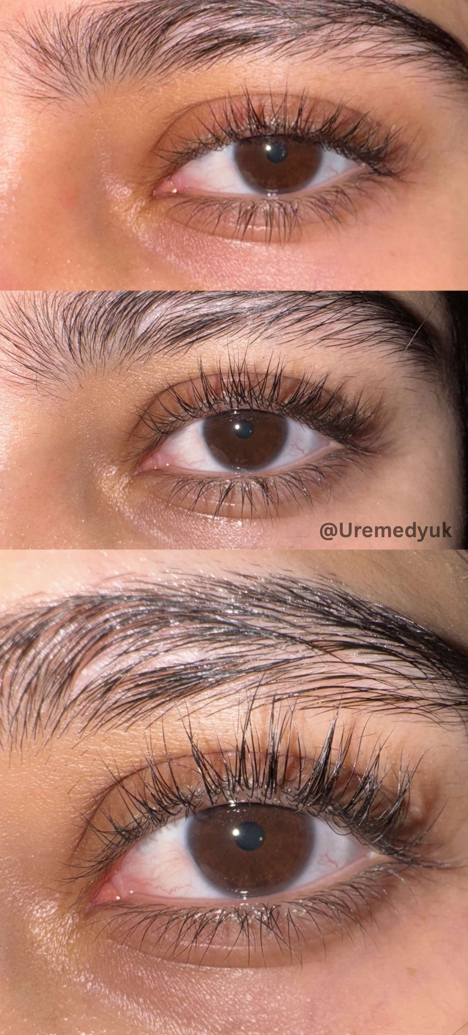 Advanced Eyelash Serum – Longer, Fuller Lashes