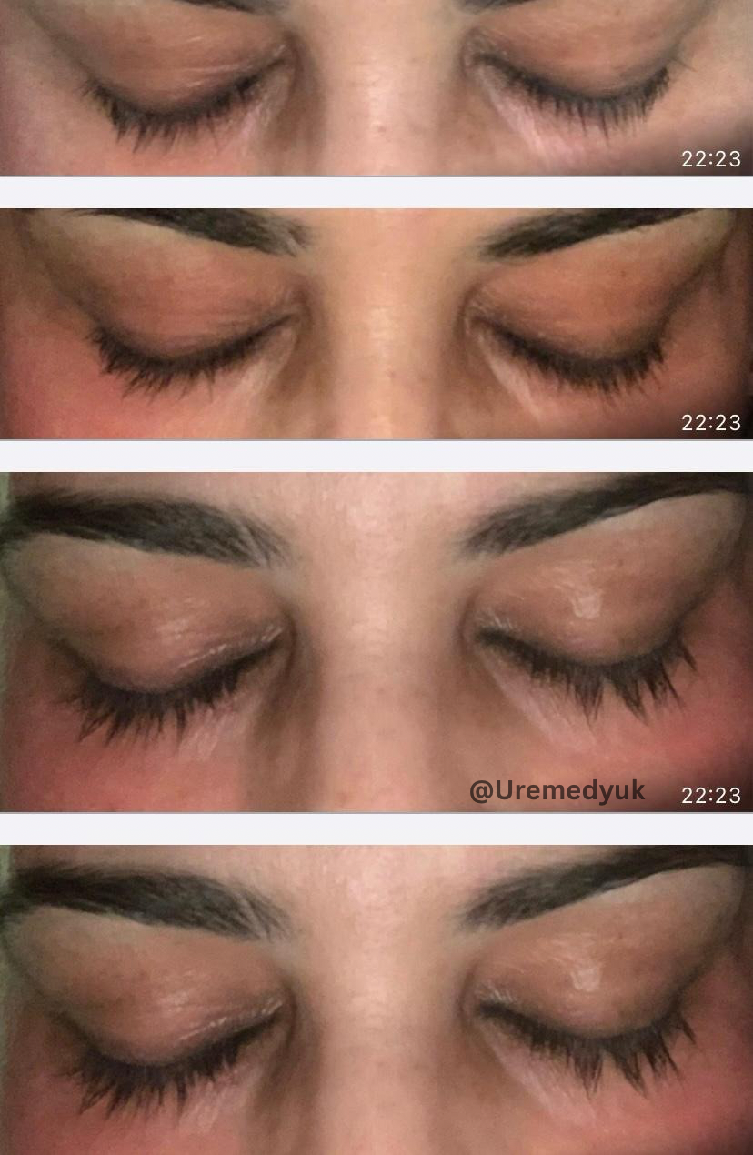 Advanced Eyelash Serum – Longer, Fuller Lashes