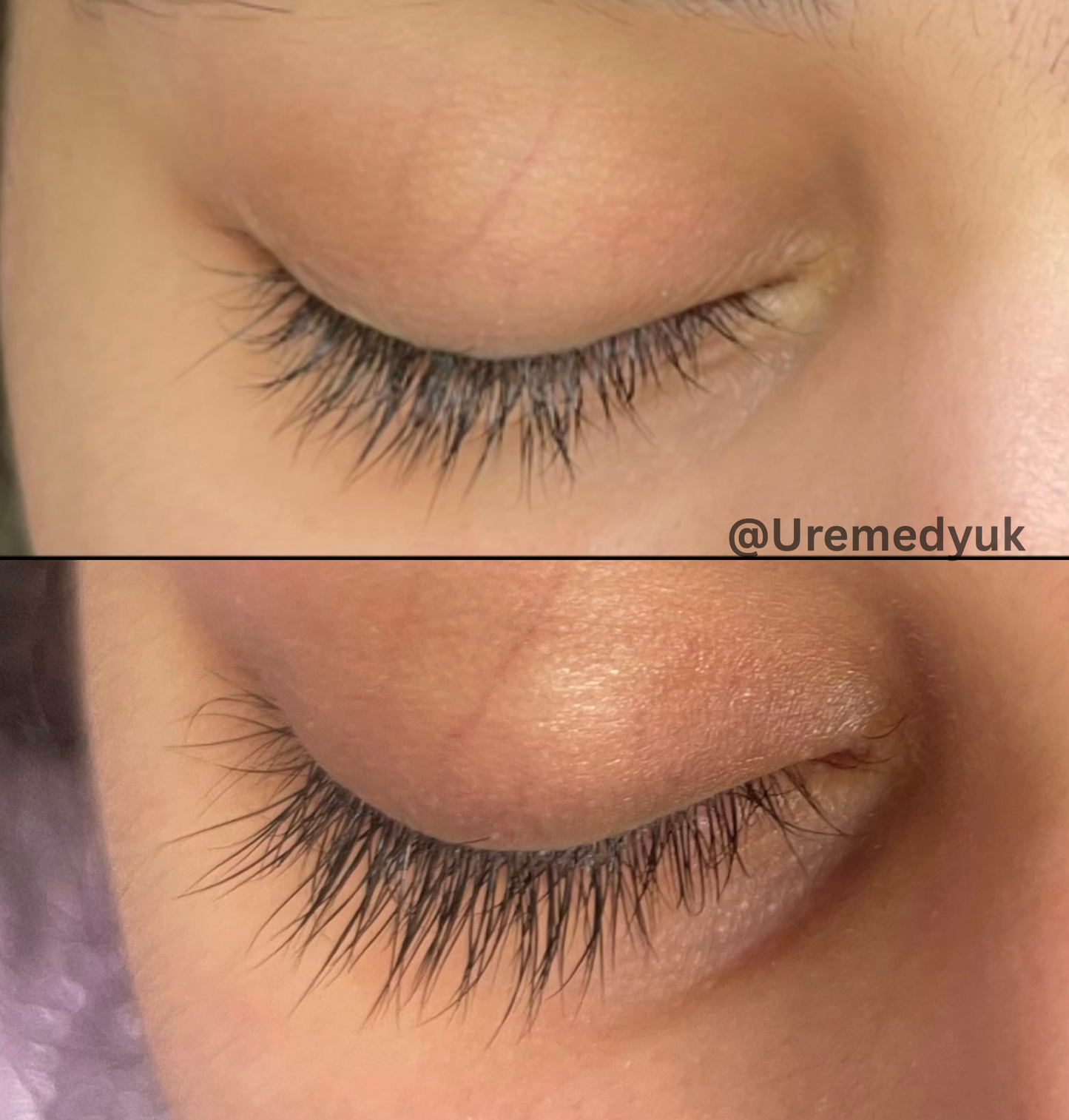 Advanced Eyelash Serum – Longer, Fuller Lashes