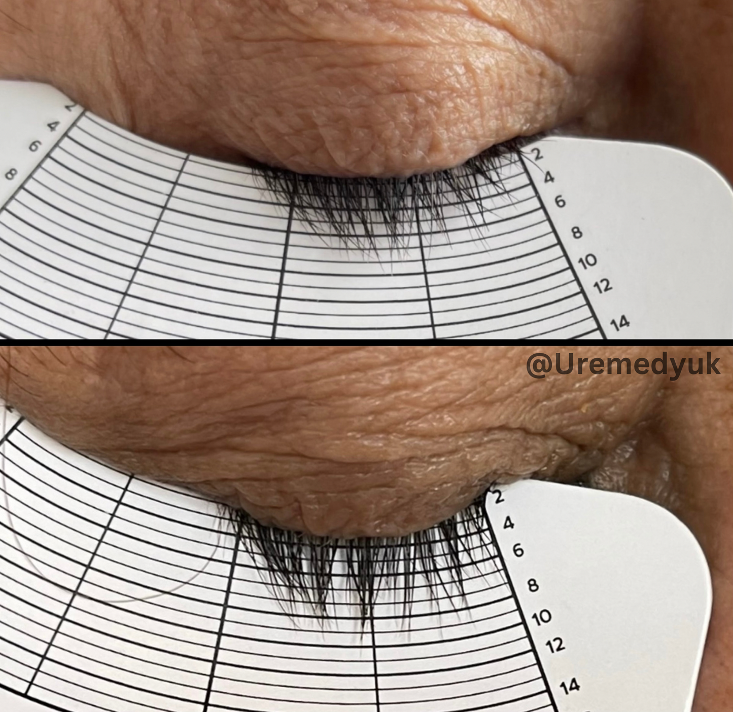 Advanced Eyelash Serum – Longer, Fuller Lashes