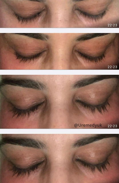 Advanced Eyelash Serum – Longer, Fuller Lashes